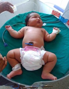भारतीय महिलाले जन्माइन् अहिलेसम्मकै ठूलो शिशु