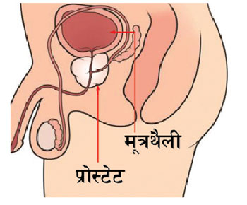 होस गर्नुस् , तपाईंलाई पुरुष ग्रन्थीसम्बन्धी समस्या हुनसक्छ !