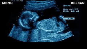 गर्भ जाँच गराउनबाट वञ्चित