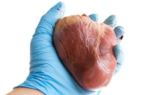 मानव अङ्ग प्रत्यारोपण केन्द्रमा मुटु रोग उपचार सेवा सुरु