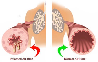 normal-and-abnormal