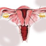 पाठेघरको मुखको क्यान्सर : स्क्रिनिङ र खोप विस्तार जरुरी