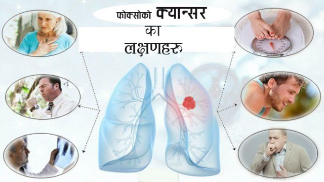 फोक्सोको क्यान्सरका लक्षण कसरी चिन्ने ?