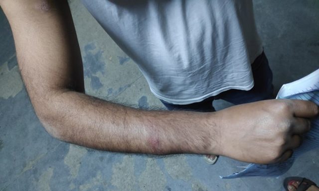 डिउटीबाट फर्कदै गरेका आवासीय चिकित्सक प्रहरीद्धारा कुटिए