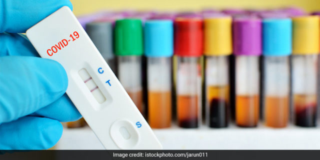 कोरोना परीक्षणका लागि नेपालमा आरटी ल्याम्प विधि भित्रदै