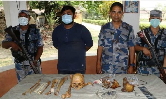 मानव अंगसहित एमबीबीएसका विद्यार्थी पक्राउ