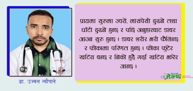 कस्तो रोग हो मंकीपक्स ? कसरी सर्छ ? लक्षणहरु के के हुन् ?