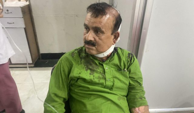 कांग्रेस नेता महेन्द्र यादवको उपचार राष्ट्रिय ट्रमा सेन्टरको आइसीयूमा
