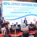 कुुष्ठरोग निवारण गरि छाड्ने प्रयत्नलाई अझ गतिशील र प्रभावकारी बनाउनुुपर्छ : प्रधानमन्त्री ओली