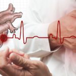 हृदयघातको जोखिमबाट आफूलाई कसरी जोगाउने ?