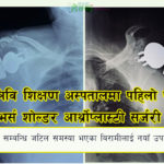 त्रिवि शिक्षण अस्पतालमा पहिलोपटक ‘रिभर्स शोल्डर आर्थ्रोप्लास्टी’ सफल