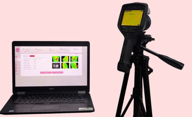 थर्मलाइटिक्स प्रविधि ‘पहिलो पटक’ नेपालमा भित्रिँदै: स्तन क्यान्सर पहिचानमा नयाँ सम्भावना